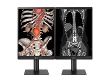 LG 21HQ513D 3MP 21" Color Medical Diagnostic Radiology Display Monitor (21HQ513D)