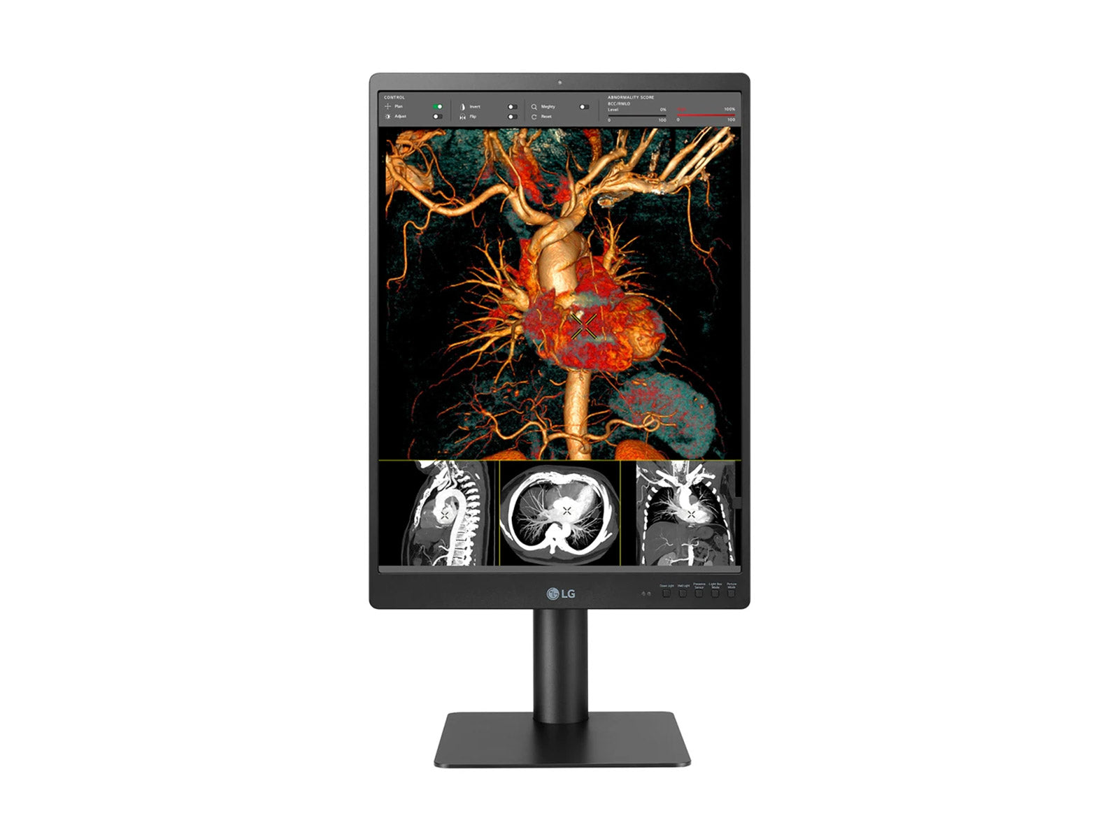 LG 21HQ513D 3MP 21" Color Medical Diagnostic Radiology Display Monitor (21HQ513D)