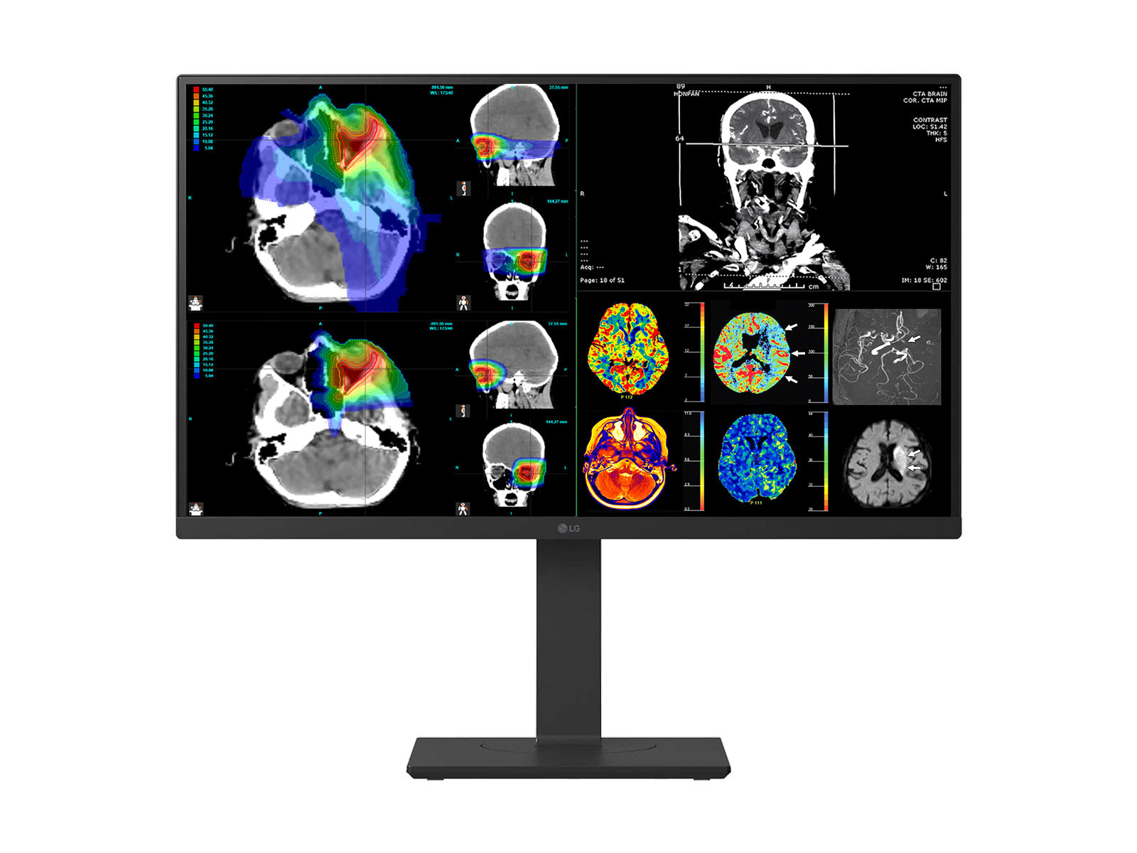 LG 27" Color Fusion 8MP 4K LED Clinical Review Medical DICOM Display Monitor (27HS713C)
