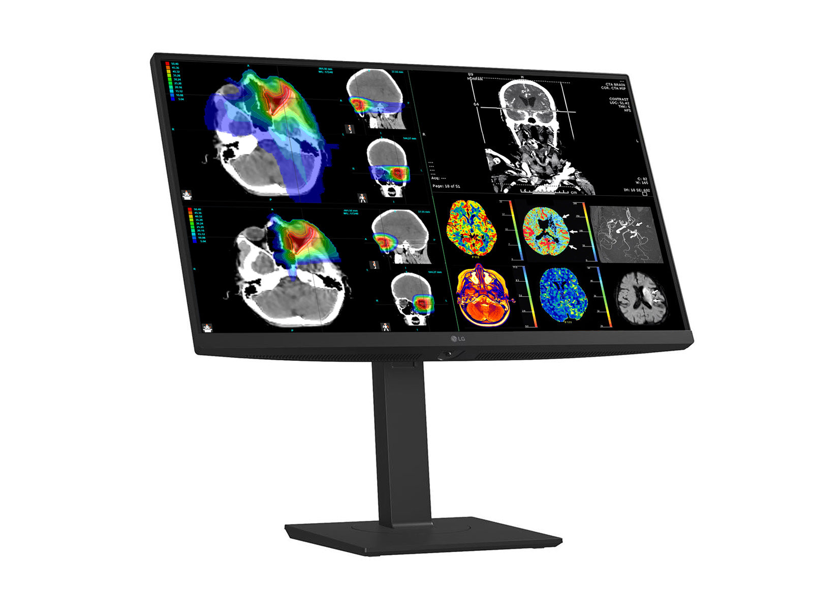 LG 27" Color Fusion 8MP 4K LED Clinical Review Medical DICOM Display Monitor (27HS713C)