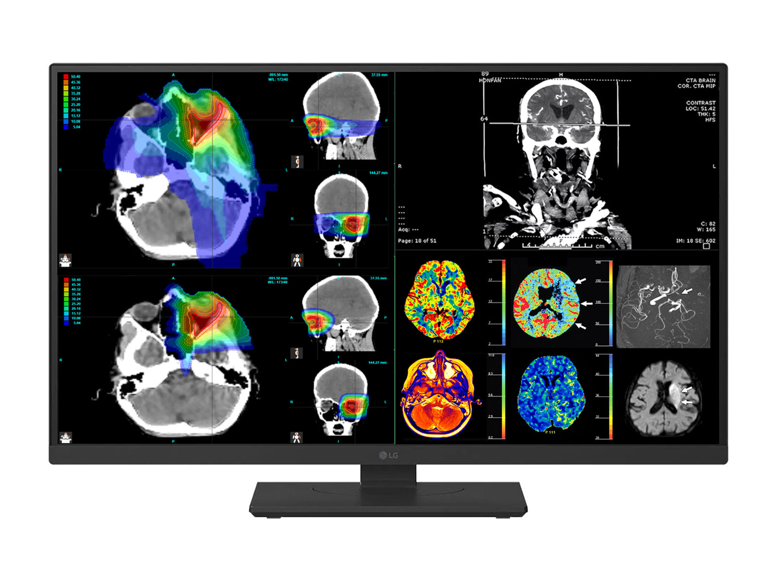 LG 27" Color Fusion 8MP 4K LED Clinical Review Medical DICOM Display Monitor (27HS713C)