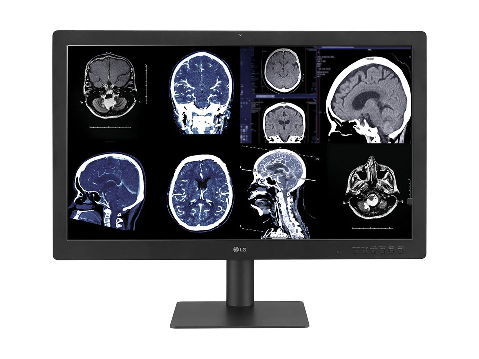 Complete Mammography Reading Station | LG 12MP Fusion 31.5" Color | HP Z2 Mini G9 Workstation | Dictation Mic | Worklist Monitors (31HN713DZ2MNG9)