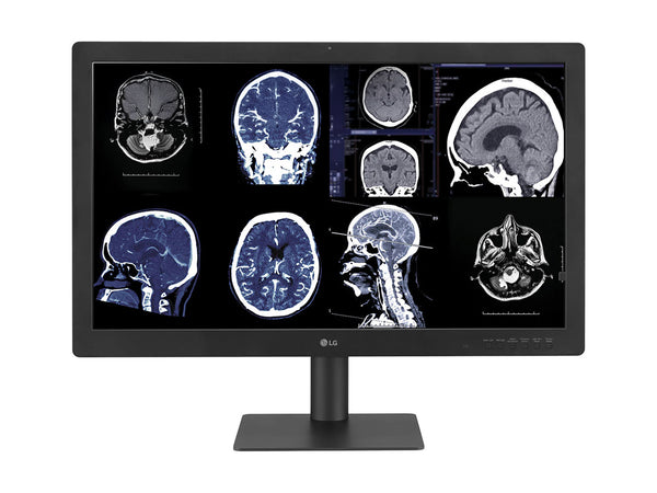 Complete Mammography Reading Station | LG 12MP Fusion 31.5