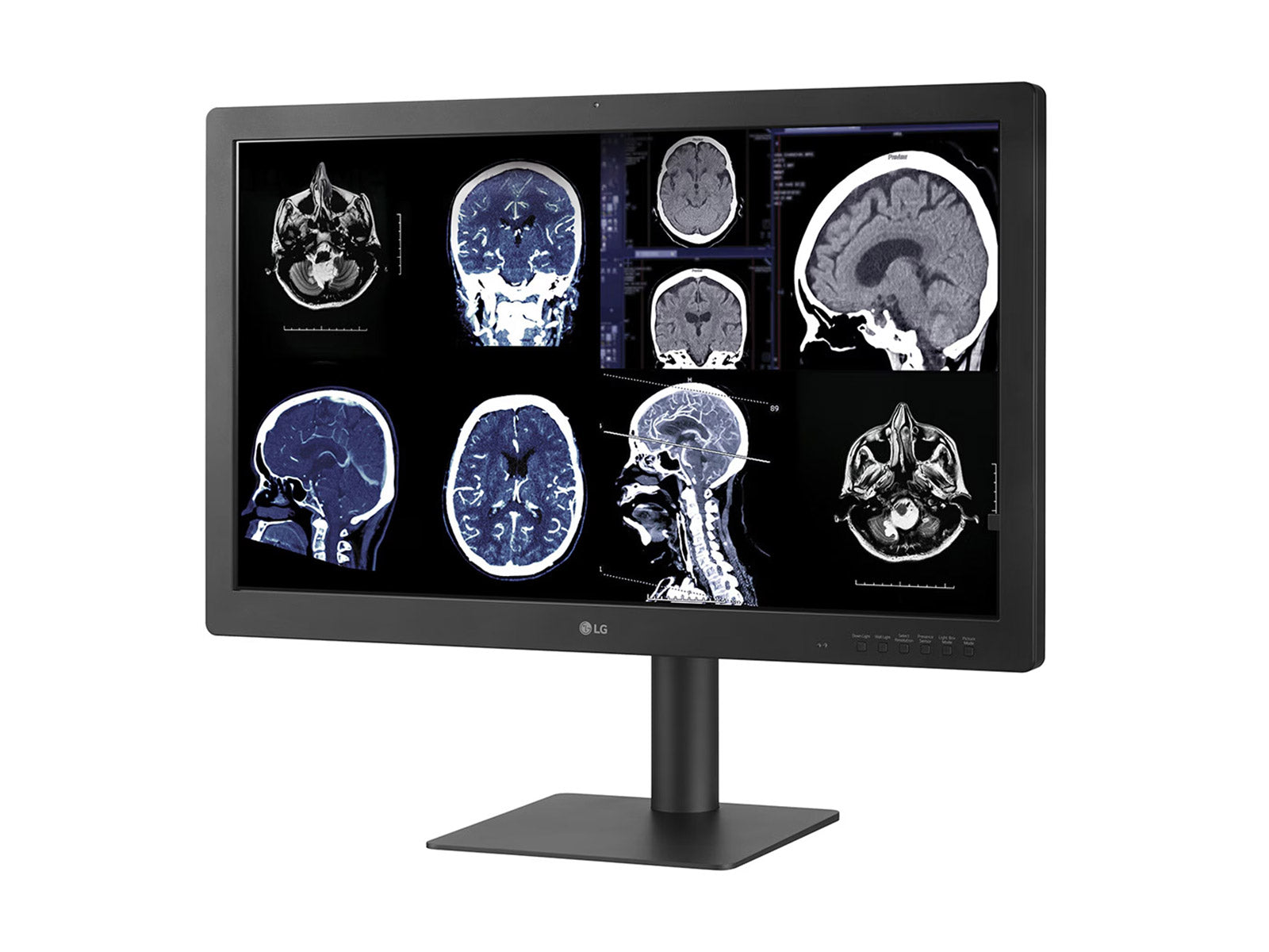 LG 32HQ713D 8MP 32" Diagnostic Fusion Color Medical Radiology PACS Monitor - 1000 cd/m² DICOM Brightness (32HQ713D)