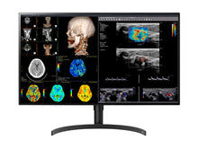 LG 8MP Fusion 4K 32" Color Medical Diagnostic Radiology Monitor 450 cd/m² DICOM Brightness (32HL512D-B)