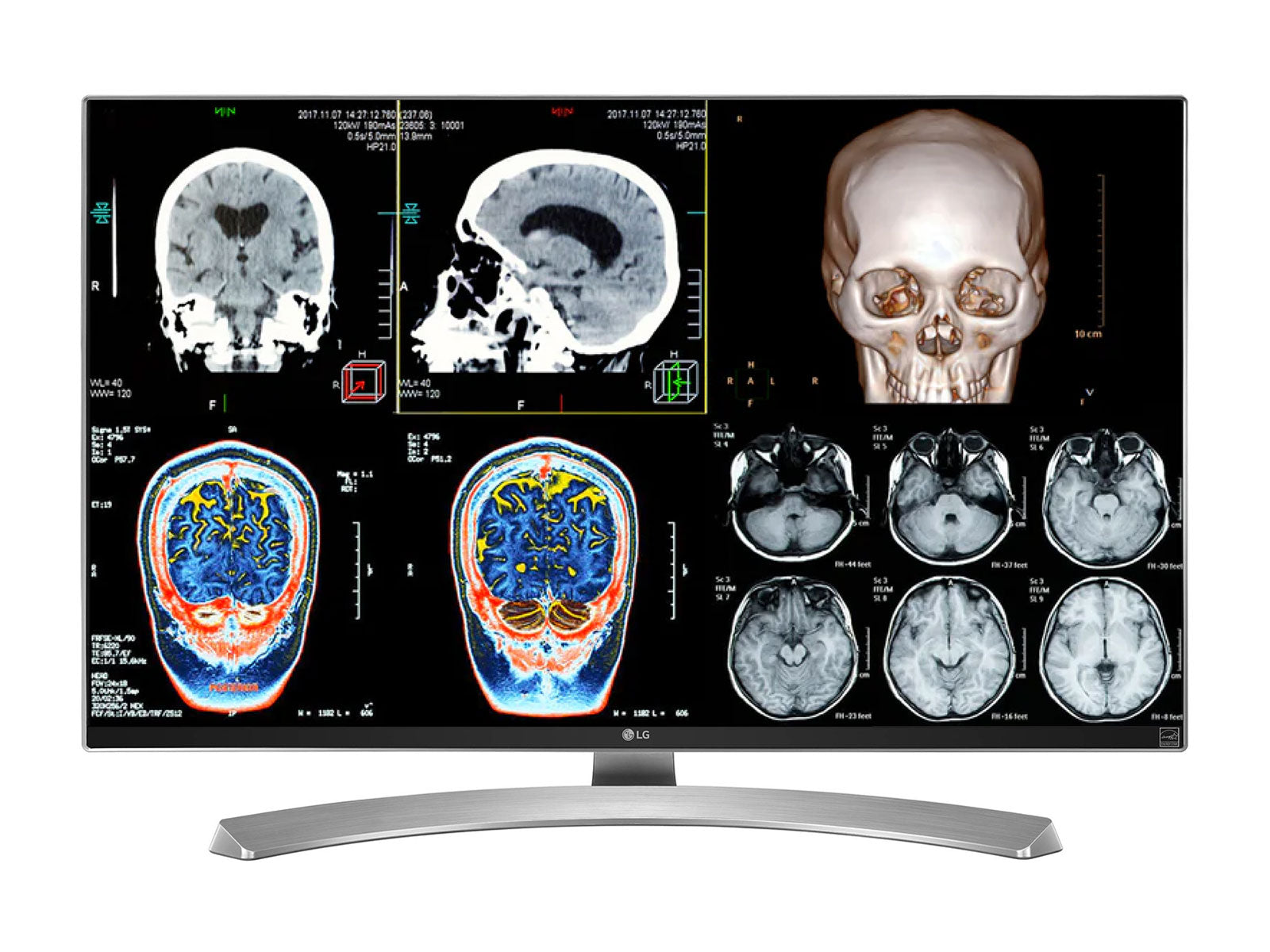 Komplet klinisk gennemgang Læsestation | 2 x LG 27 "8MP Color Clinical Review viser | HP ZBook Studio 16 G9 | Diktat Mic | PerfectLum Calibration Package (LGHP16G9)