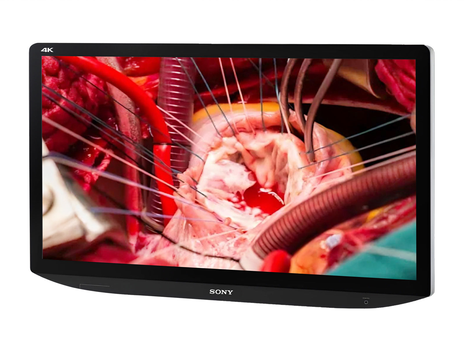 Sony LMD-X310MT 31" LCD 4K 3D/2D Surgical Medical Display Monitor (LMD-X310MT)