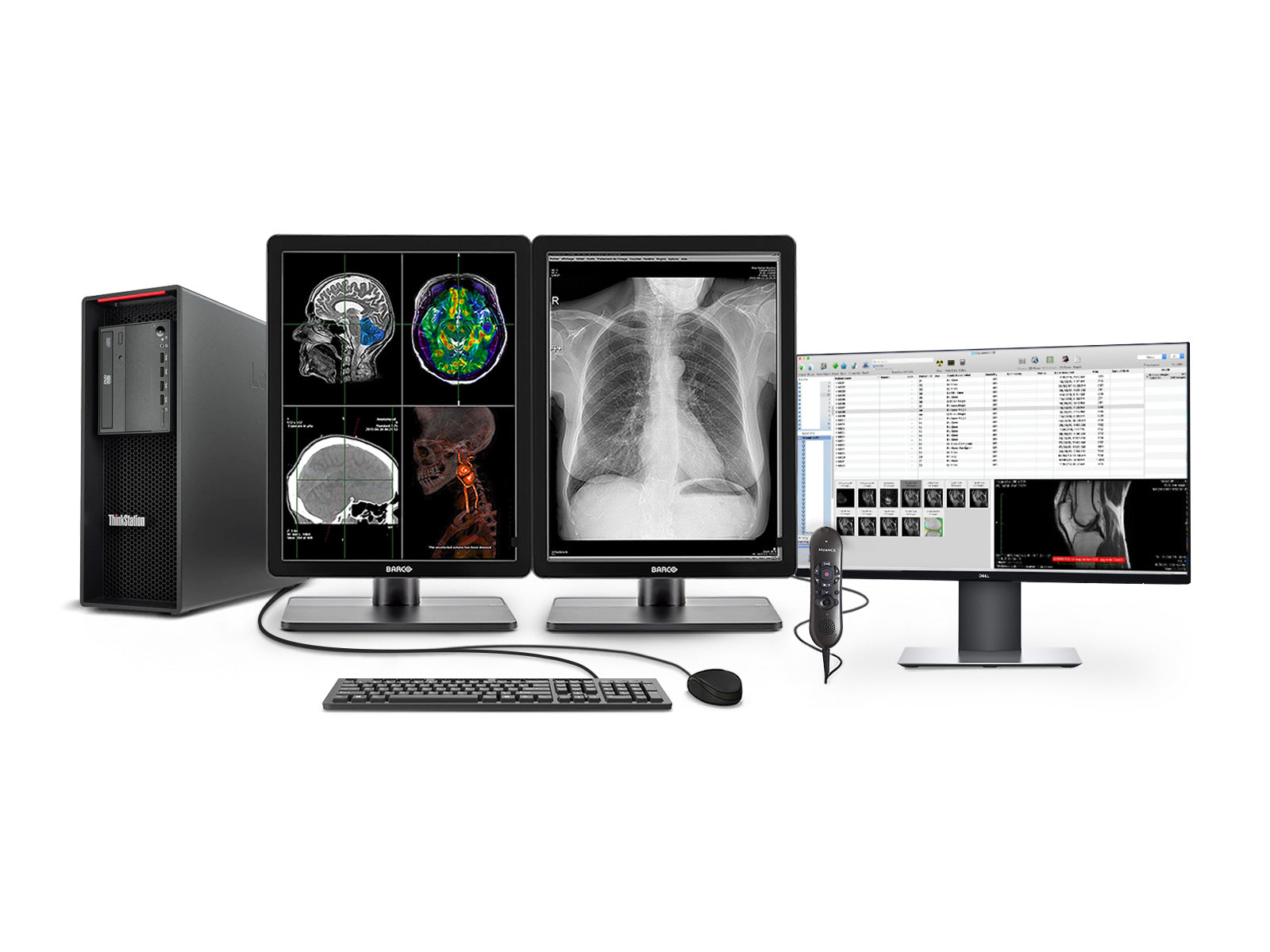 完全なPACS General Radiology Station | Barco 3MPカラーLEDディスプレイ| HPワークステーション|ディクテーションマイク|ワークリストモニター（3321Z4R）