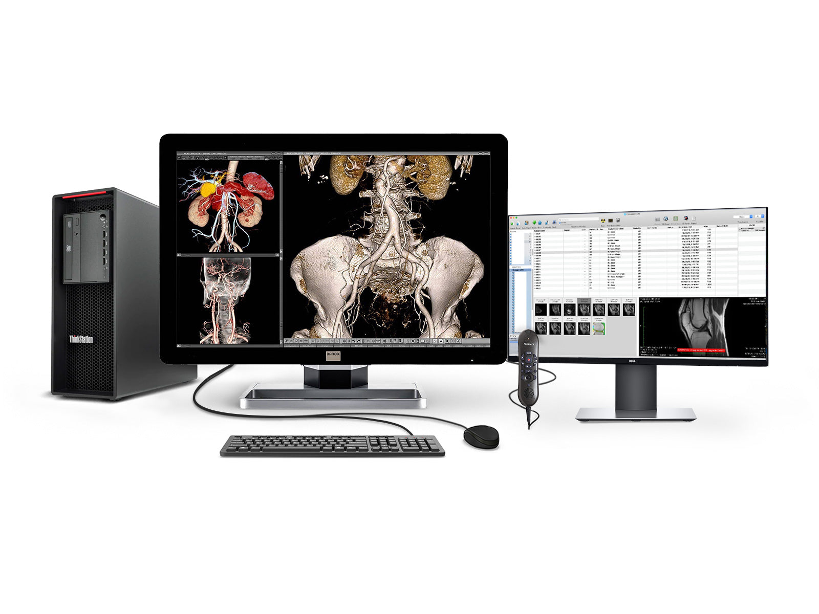 Complete PACS General Radiology Station | Lenovo Workstation