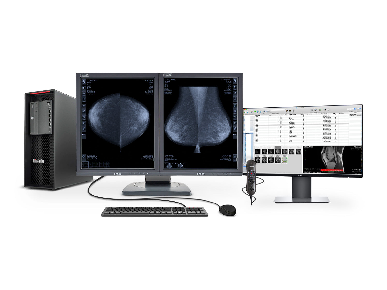 Complete Mammography Reading Station | Lenovo Workstation