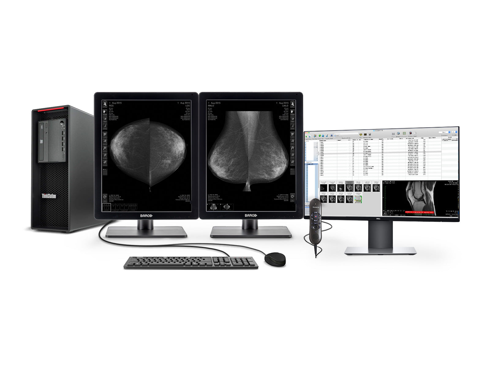 Complete Mammography Reading Station | Barco 5MP Grayscale LED Monitor | Lenovo Workstation | Dictation Mic | Worklist Monitor (5221Z4R)