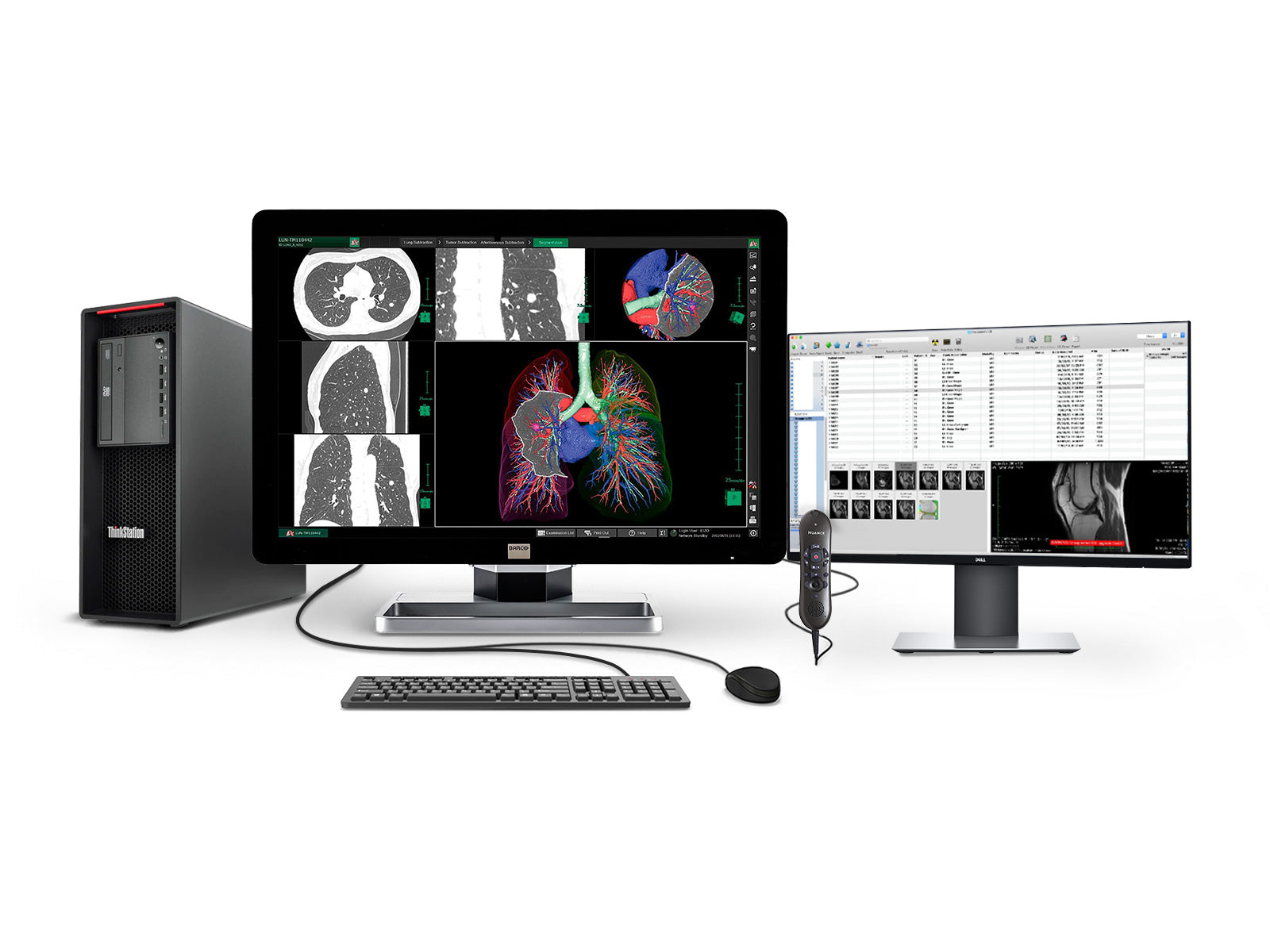 Estação de Radiologia Geral PACS Completa | Tela LCD colorida de 6MP da Barco | Lenovo Estação de trabalho | Microfone de Ditado | Monitor de lista de trabalho (6130Z4)