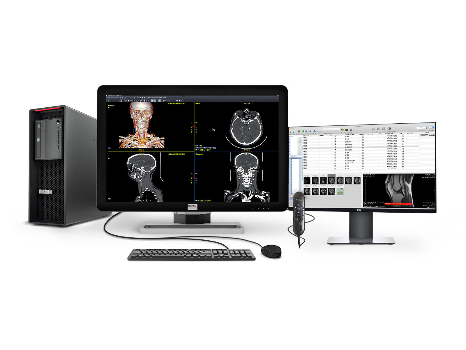 Station de lecture de radiologie générale PACS complète | Barco 6MP MDCC-6430 | Lenovo Poste de travail | Micro Nuance | Moniteurs de liste de travail 24 po (6430Z4R)