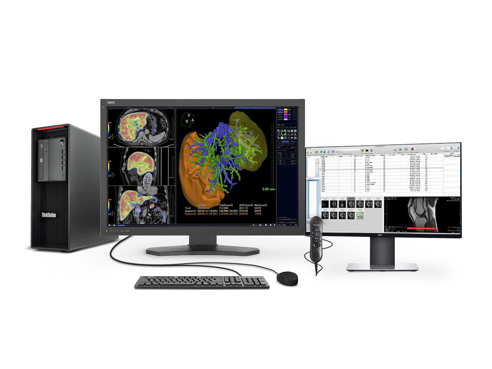 NEC Complete PACS General Radiology Station | Lenovo Workstation