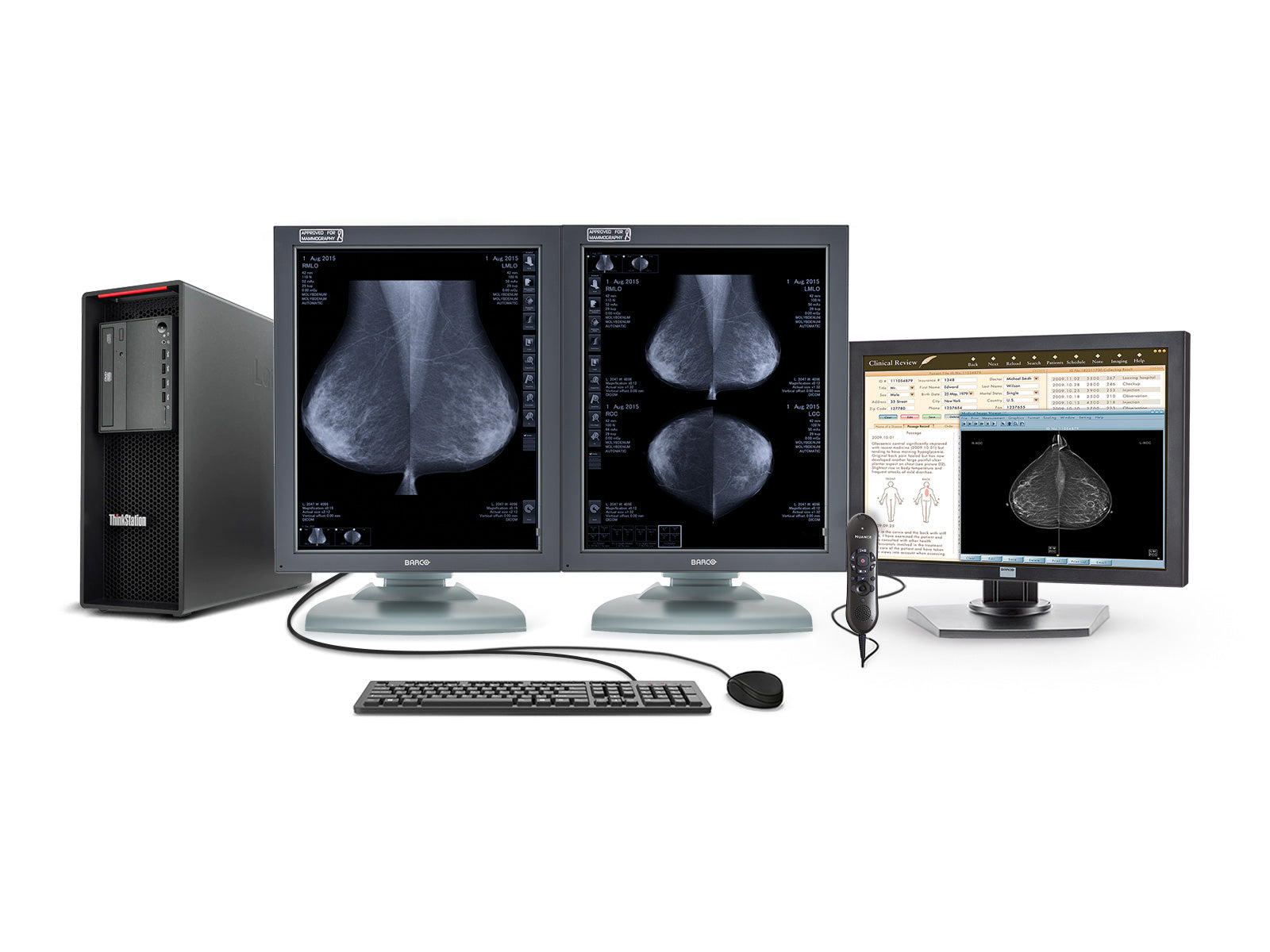 Compleet PACS Mammografie Leesstation | Barco 5MP Grijstinten Beeldschermen | Lenovo Werkstation | Dicteren Microfoon | Monitor voor werklijsten (MG5121Z4R)