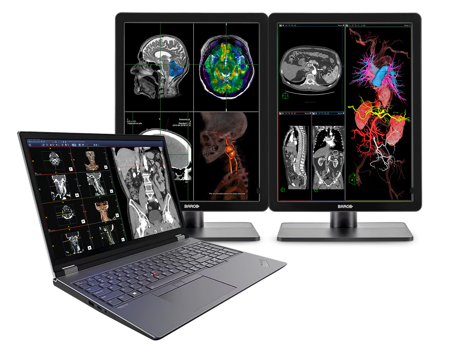 Lenovo ThinkPad P16 16" Mobile Radiology Workstation | 4K+ UHD 9MP DICOM OLED Touchscreen 400nits Display | Intel Core i9-12900HX @ 5.0GHz | Up to 128GB DDR5 | 1TB NVMe SSD | Nvidia RTX A4500 16GB | Win10-11 Pro