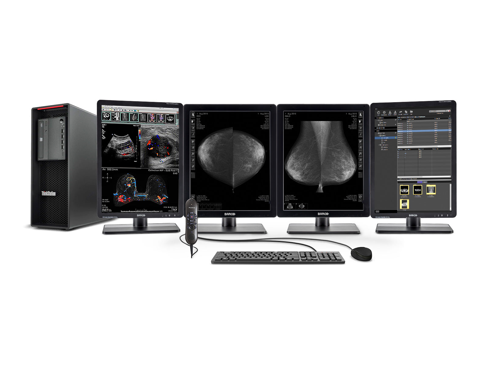 Complete Mammography Reading Station | Barco 5MP Grayscale LED Monitor | Lenovo Workstation | Dictation Mic | Worklist Monitors (QNG5221Z4R)