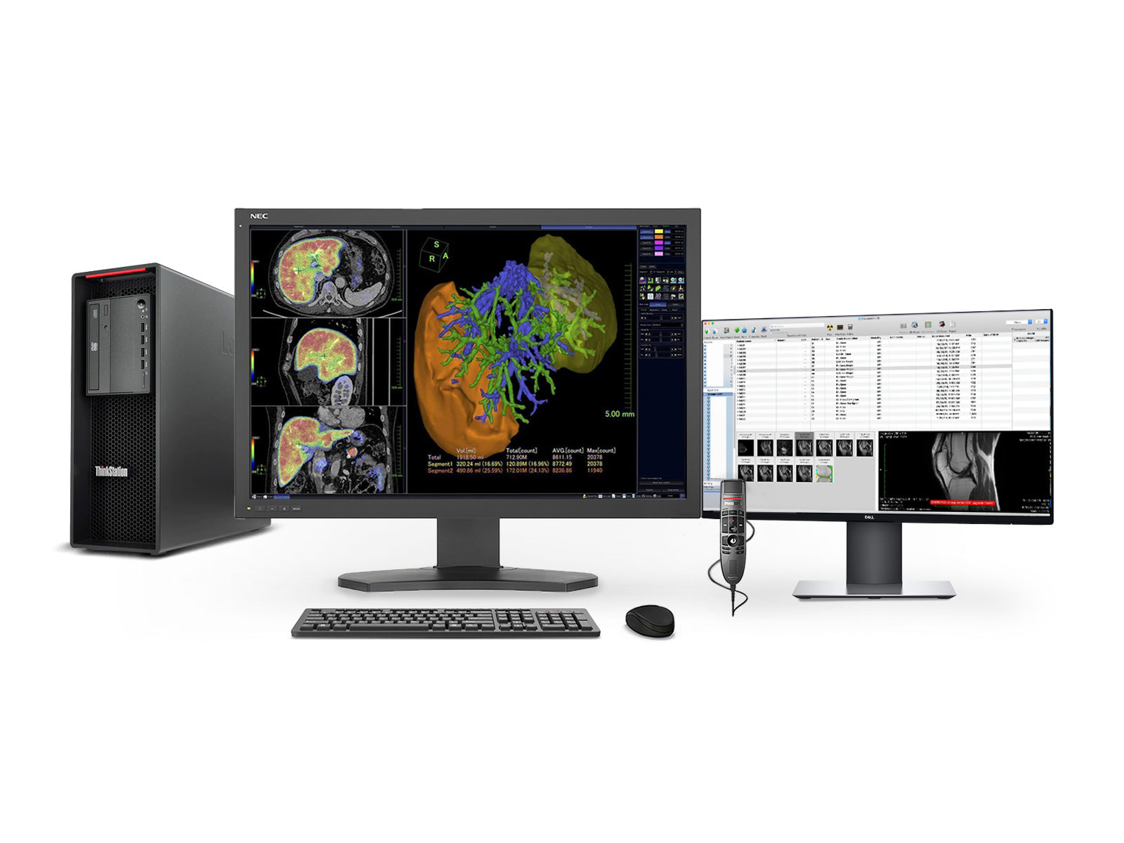 Complete PACS General Radiology Station | NEC 6MP MD302C6 Color LED Display | Lenovo Workstation | Dictation Mic | Worklist Monitor (MD302C6Z4)