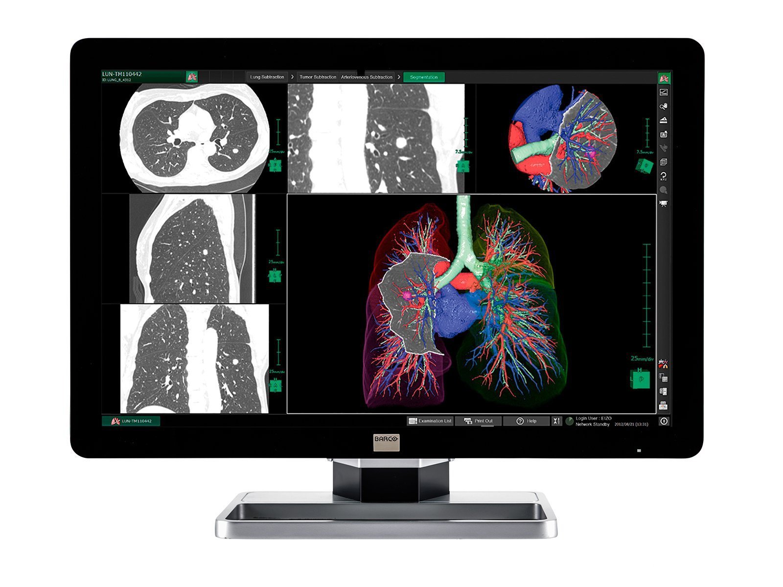 Complete PACS General Radiology Station | Barco 6MP MDCC-6130 Color LCD Display | HP Workstation | Dictation Mic | Worklist Monitor (6130Z4)