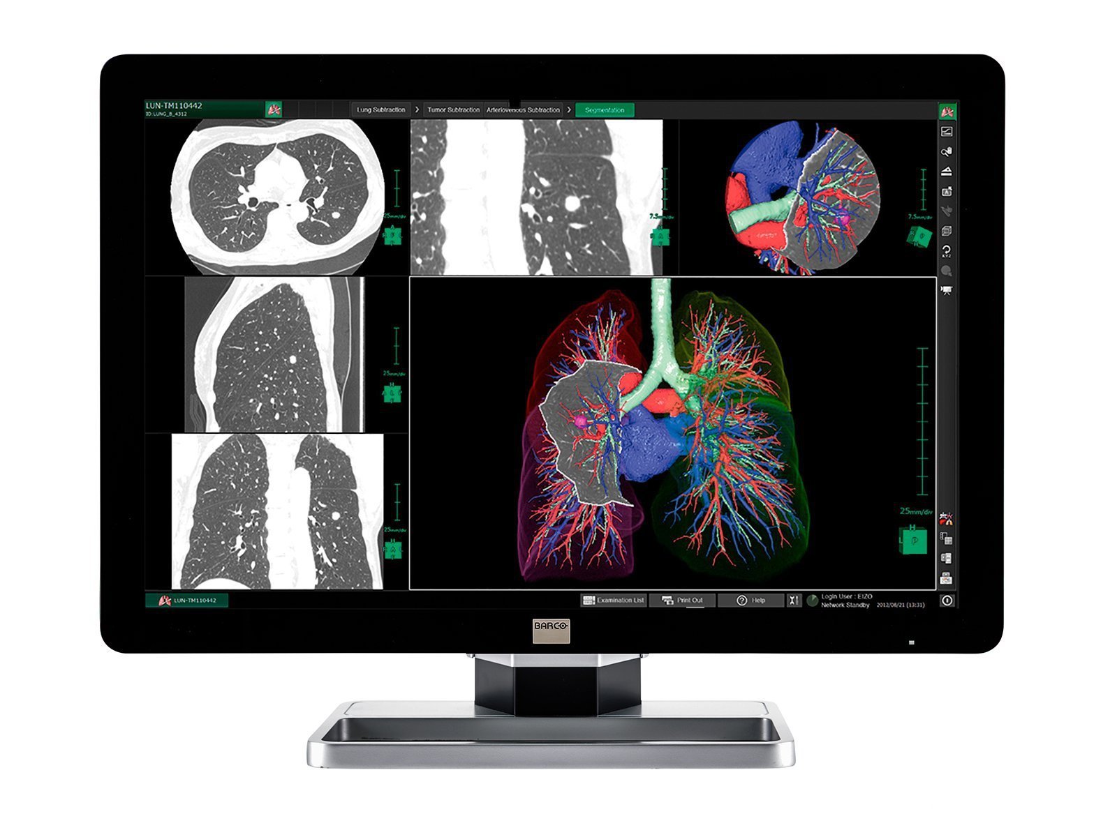 Compleet PACS Algemeen Radiologie Station | Barco 6MP LCD-kleurenscherm | Lenovo Werkstation | Dicteren Microfoon | Werklijst Monitor (6130Z4)