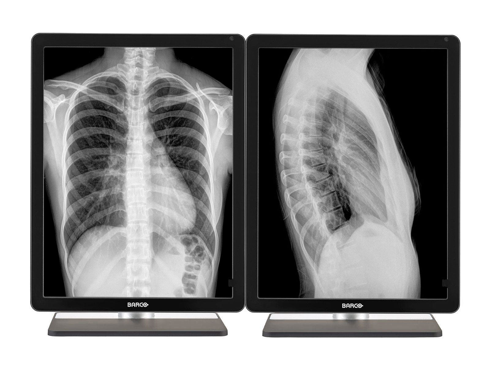 Barco Coronis MDCG-3221 3MP 21" Grayscale LED General Radiology Diagnostic Display (K9301366A)