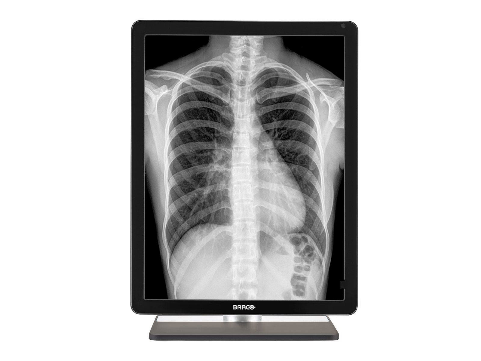 Barco Coronis MDCG-3221 3MP 21" Grayscale LED General Radiology Diagnostic Display