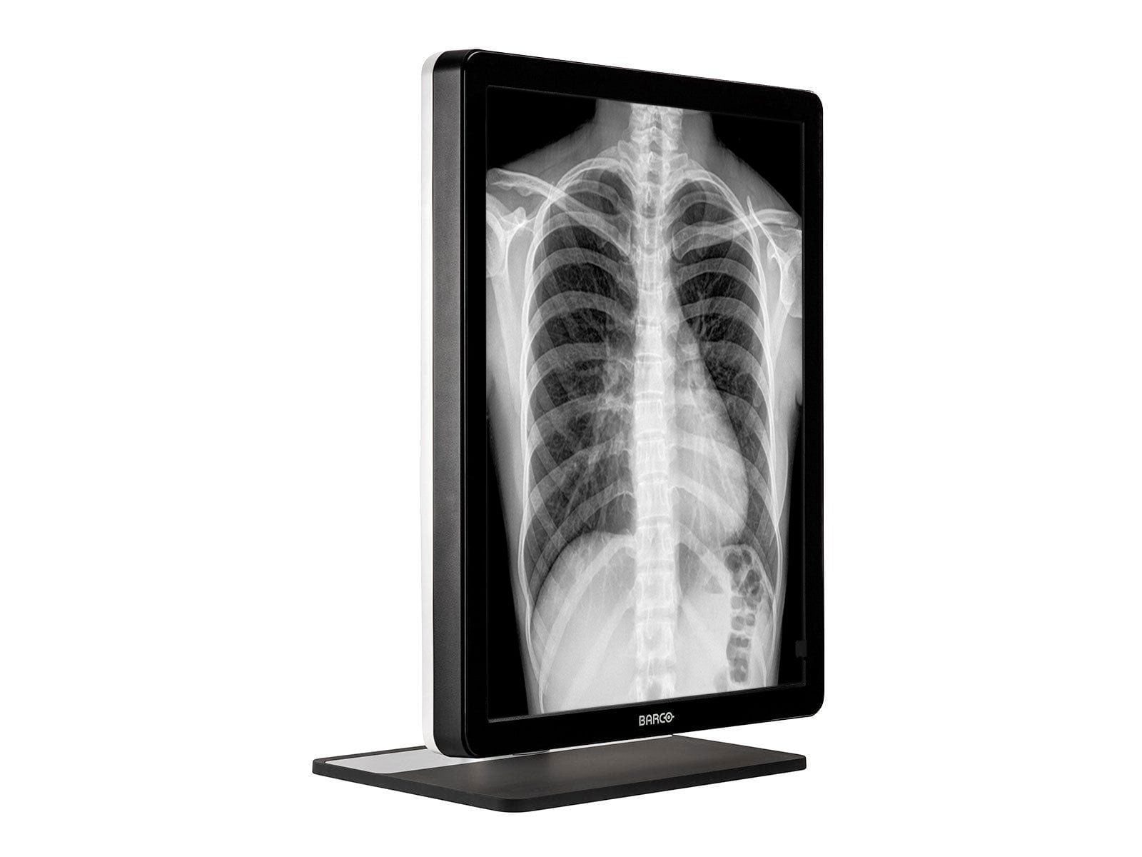 Barco Coronis MDCG-3221 3MP 21" Grayscale LED General Radiology Diagnostic Display