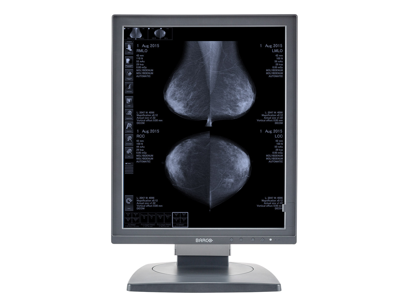 Complete Mammography Reading Station | Barco 5MP Grayscale 3D-DBT Displays | HP Workstation | Dictation Mic | Worklist Monitor (MD5121Z4R) Monitors.com 