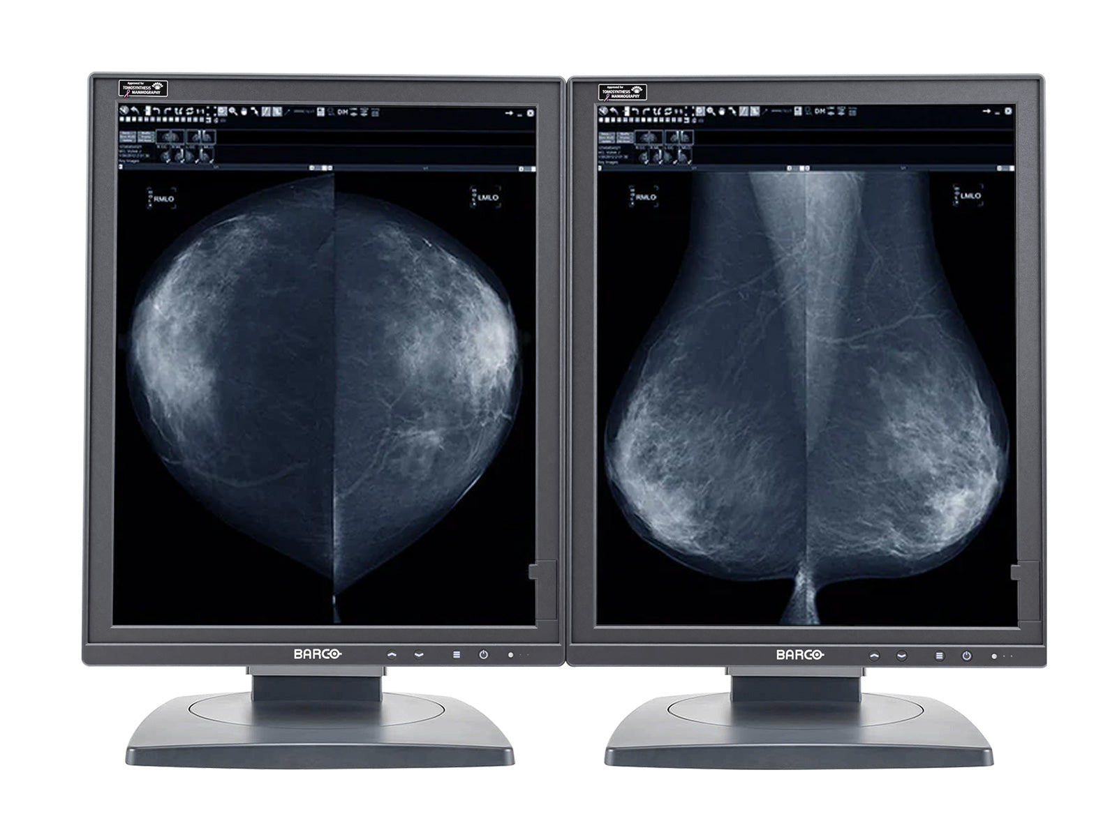 Barco Coronis MDMG-5221 5MP 21" Grayscale Tomosynthesis 3D-DBT Mammography Display