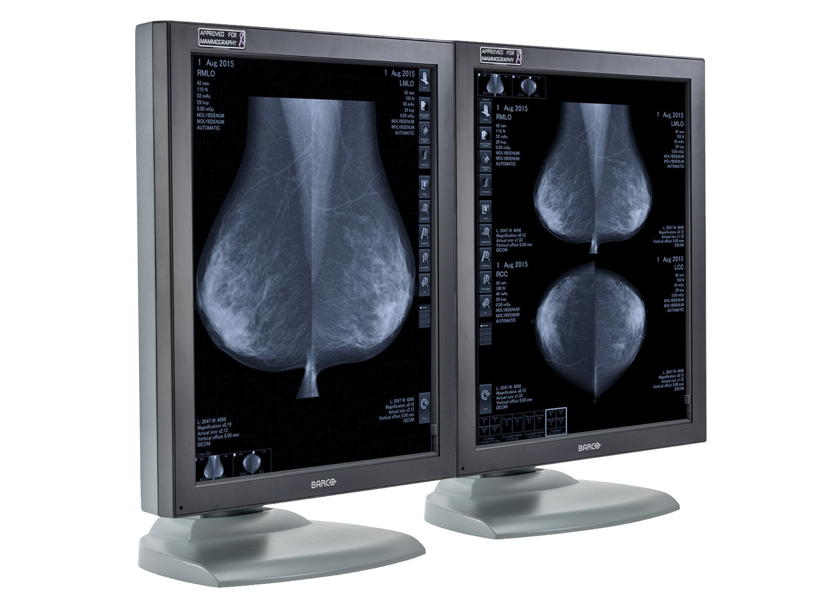 Complete Mammography Reading Station | Barco 5MP Grayscale Displays | HP Workstation | Dictation Mic | Worklist Monitor (MG5121Z4R) Monitors.com 