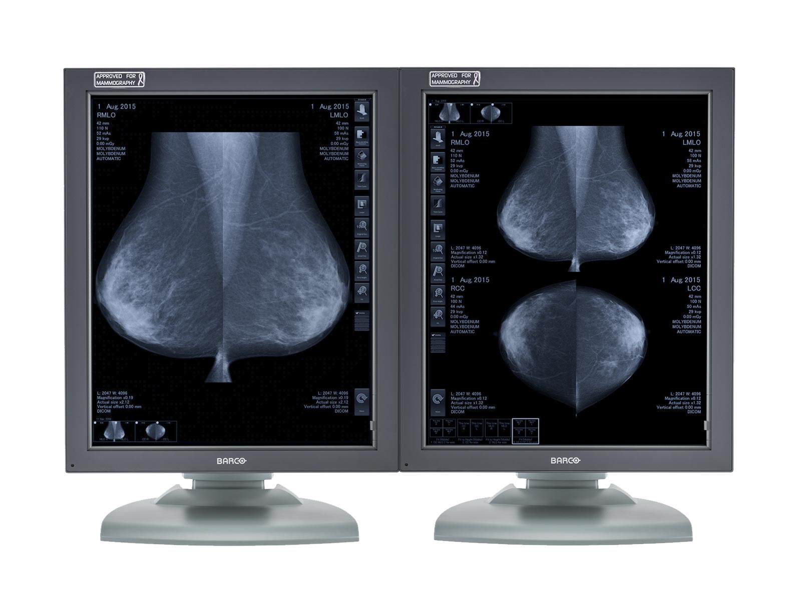 Complete PACS Mammography Reading Station | Barco 5MP Grayscale Displays | Lenovo Workstation | Dictation Mic | Worklist Monitor (MG5121Z4R)