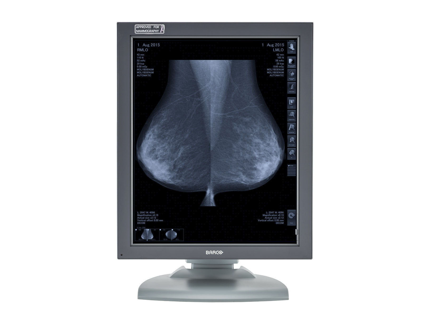 Barco Coronis MDMG-5121 5MP 21" Grayscale Breast Imaging PACS Mammography Display