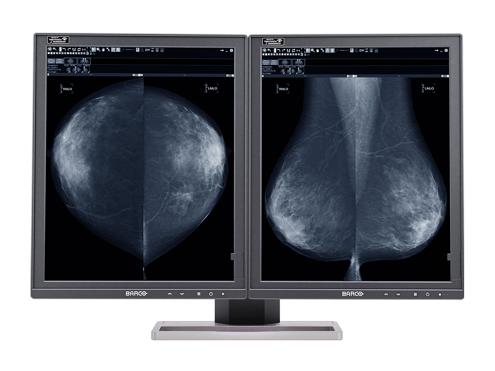 Barco Coronis MDMG-5221 5MP 21" Grayscale Tomosynthesis 3D-DBT Mammography Display (K9300520)