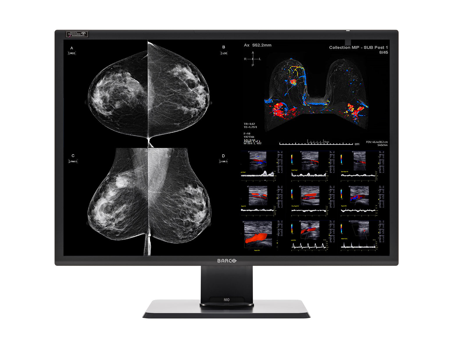 Barco Nio Fusion MDNC-12130 12MP 31" Color Tomosynthesis 3D-DBT Mammography Display