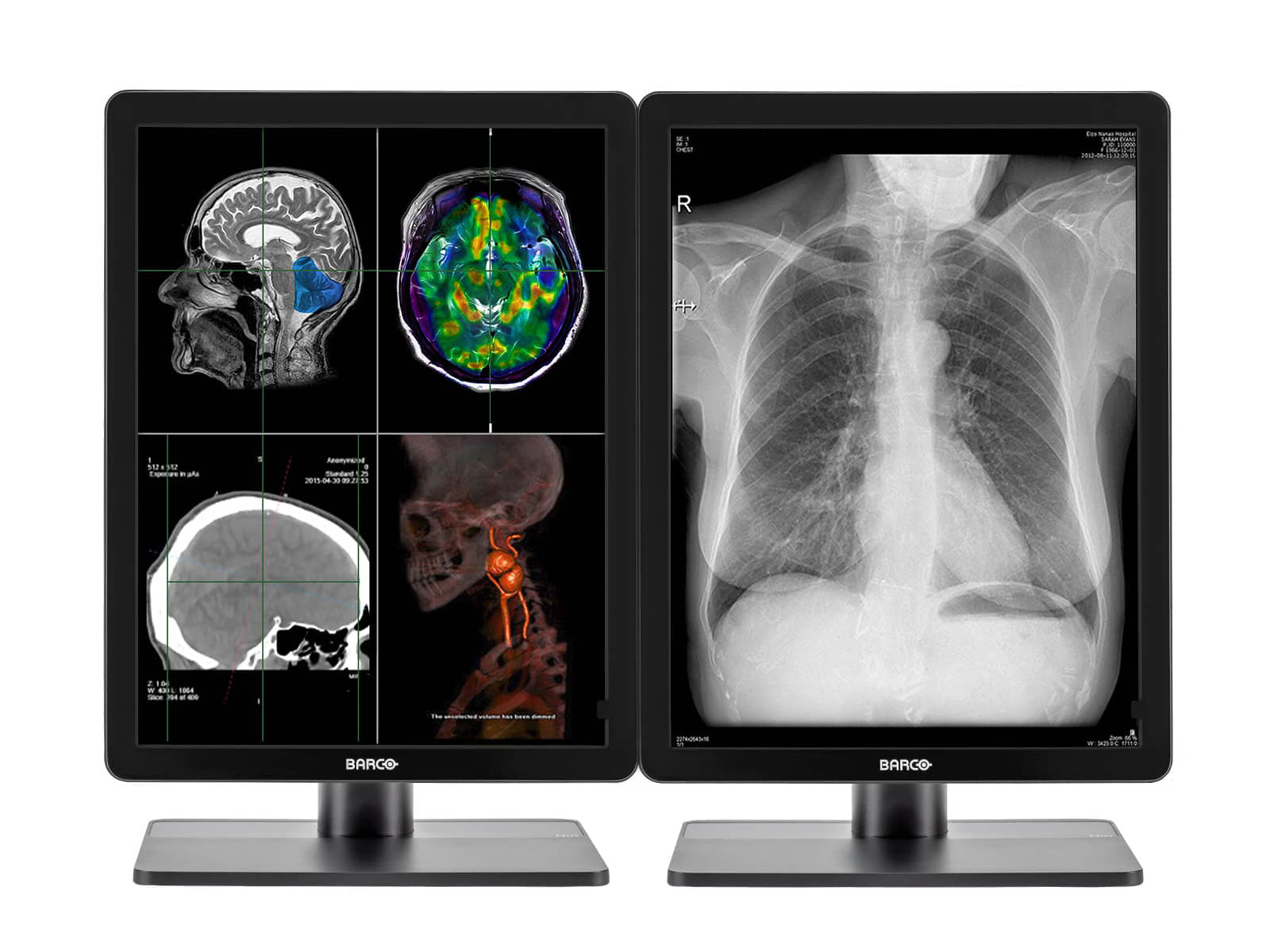 Barco Nio MDNC-3321 3MP 21" Color LED General Radiology Diagnostic PACS Display (K9300323A)