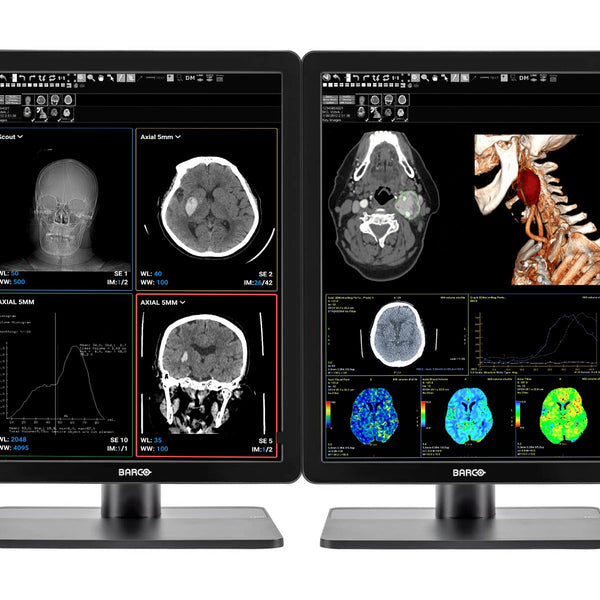 Barco® Nio MDNC-3421 3MP Color LED Radiology PACS Display (K9602861)
