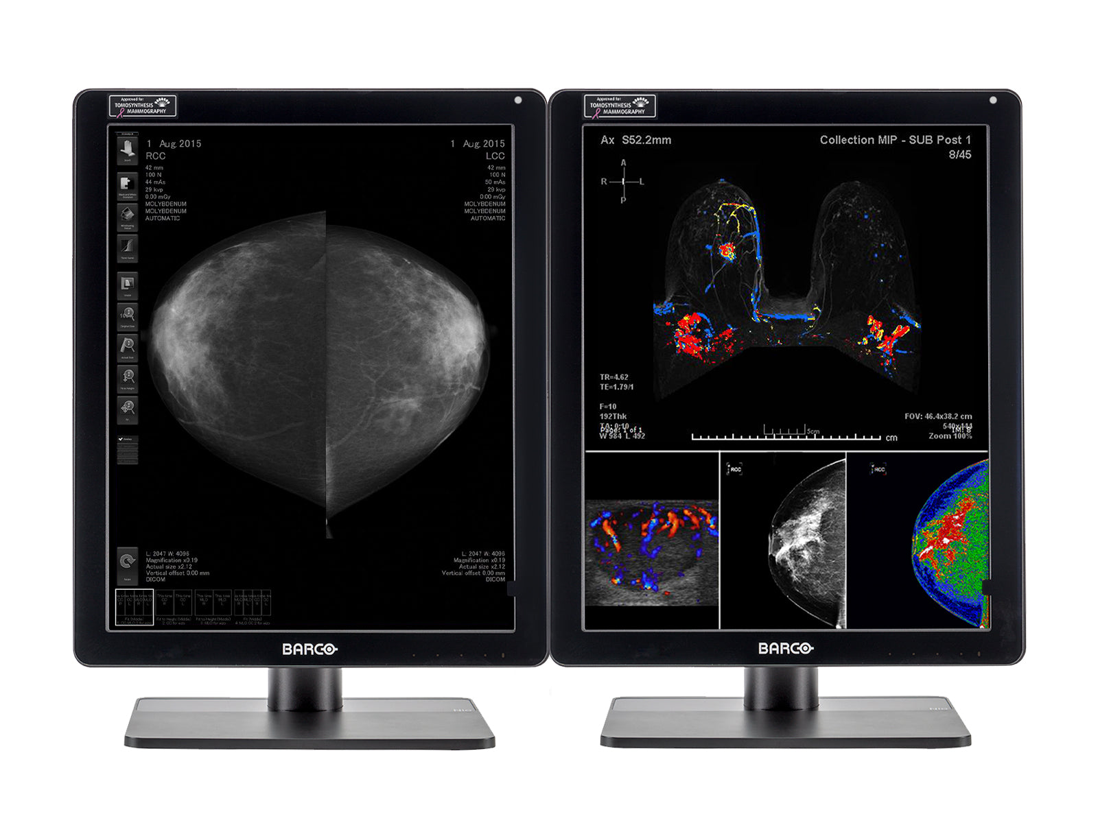 Complete Mammography Reading Station | Barco 5MP MDNC-6121 Color LED Monitors | HP Z4 G5 Workstation | Dictation Mic | Worklist Monitors (61212221)
