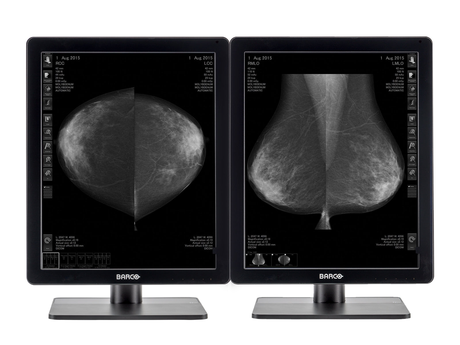 Complete Mammography Reading Station | Barco MDNG-5221 5MP Grayscale LED Monitors | HP Workstation | Dictation Mic | Worklist Monitor (5221Z4R)