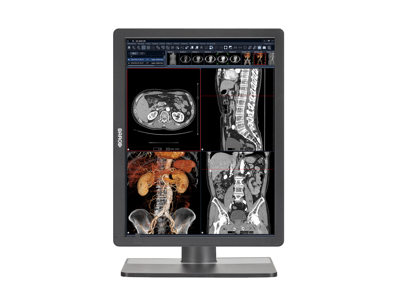 Barco Eonis MDRC-2321 2MP 21" Color Clinical Review Display (K9350051)