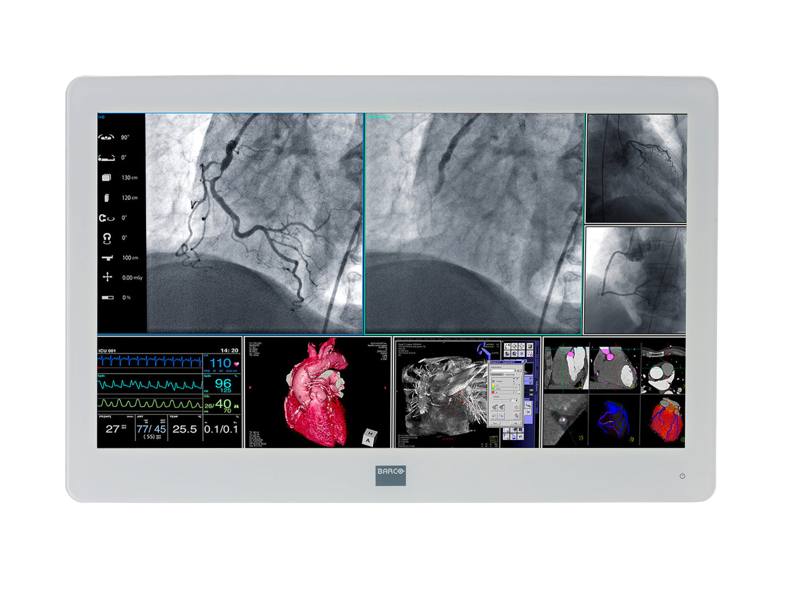 Barco MDSC-2226 MNA 26" 2MP Full HD Surgical Medical Display Monitor (K9307908)