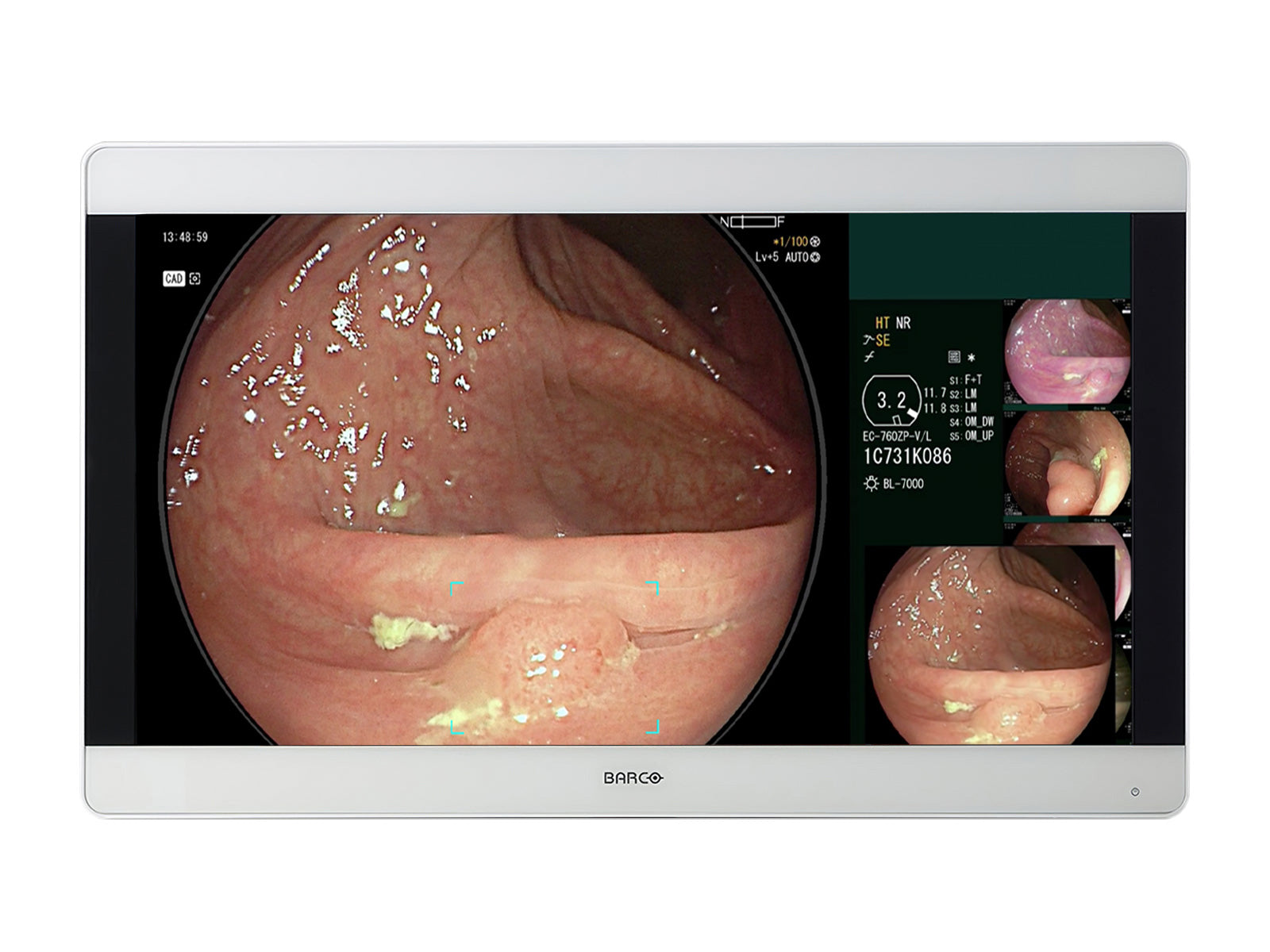 Barco MDSC-8331 LED ISM 31” 8MP 4K UHD Surgical Medical Display Monitor (991932399111)