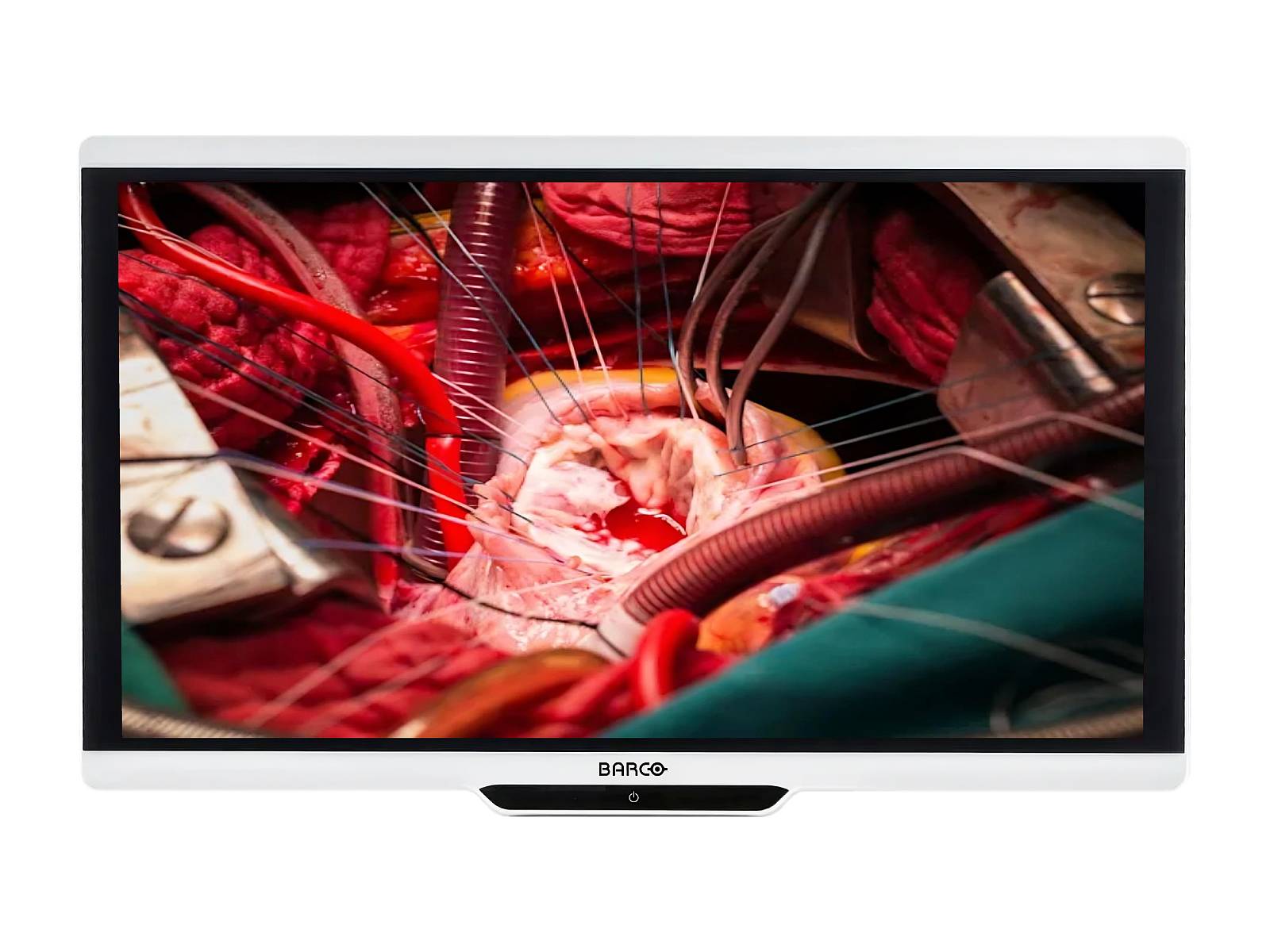 Barco MDSC-2242 Moniteur d’affichage médical chirurgical couleur Full HD 42" 2MP (K9307914)