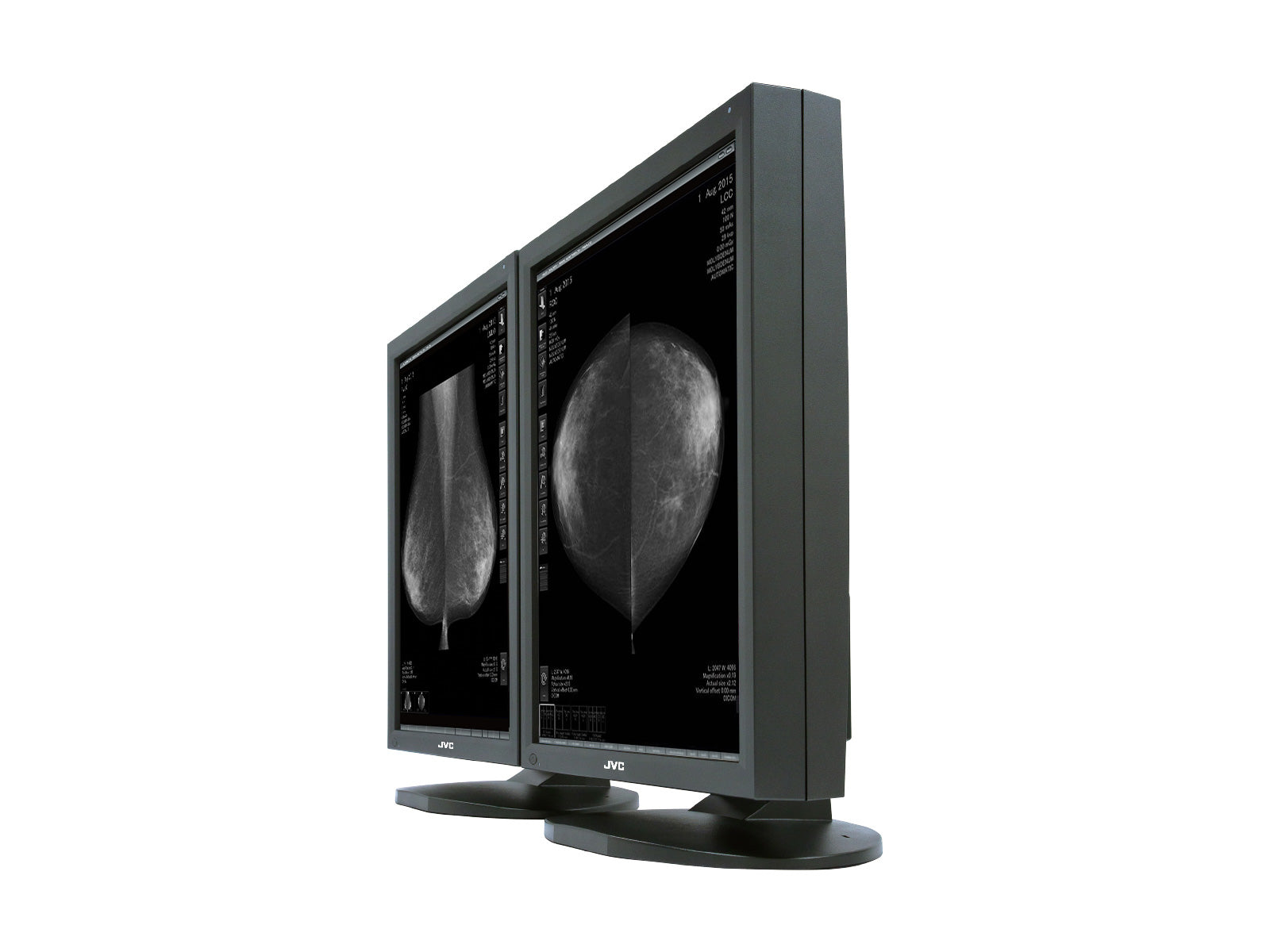 JVC Totoku MS55i2 5MP 21" Color LCD Mammo 3D-DBT Breast Imaging Display (MS55i2)