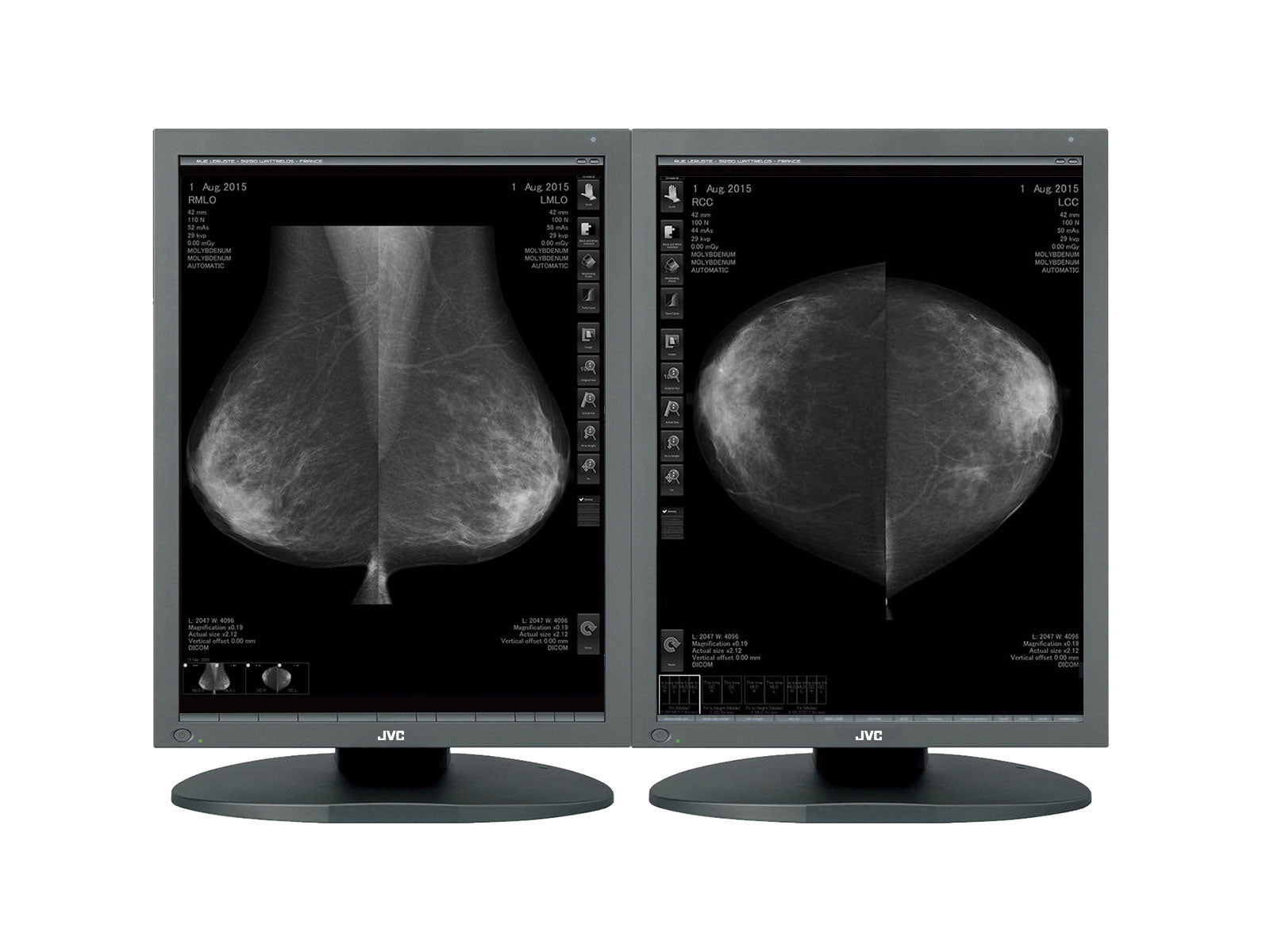 JVC Totoku MS55i2 5MP 21" Color LCD Mammo 3D-DBT Breast Imaging Display (MS55i2)