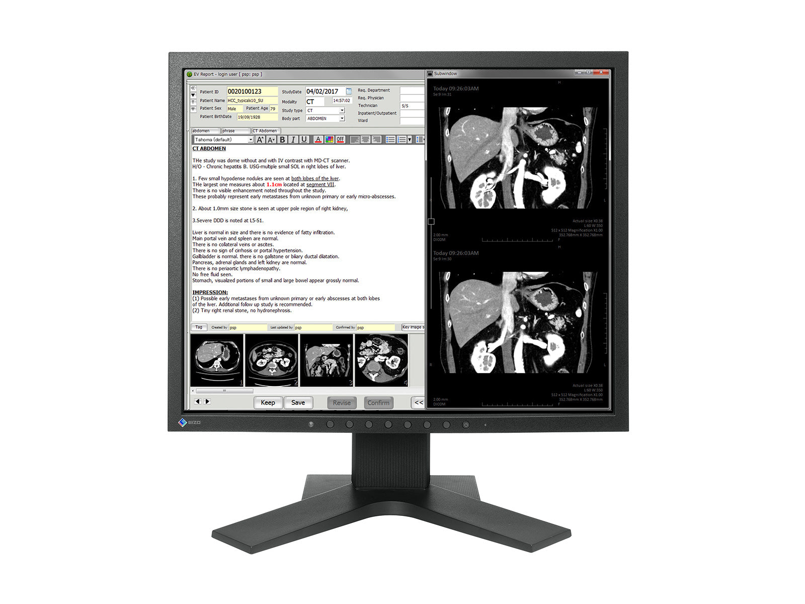 Eizo Radiforce MX194 1MP 19" Clinical Review Monitor (MX194)
