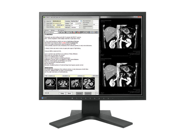 Eizo Radiforce MX194 1MP 19" Clinical Review Monitor (MX194)