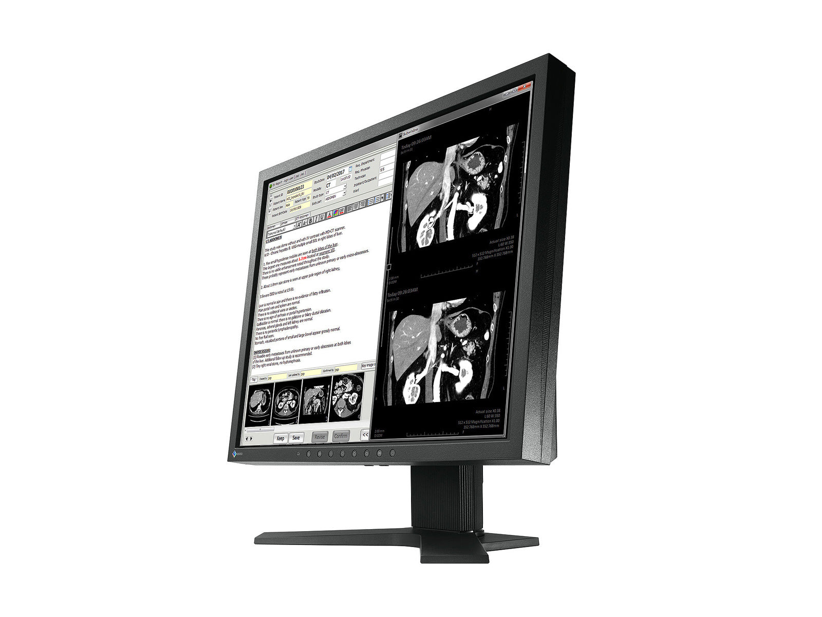 Eizo Radiforce MX194 1MP 19" Clinical Review Monitor (MX194)