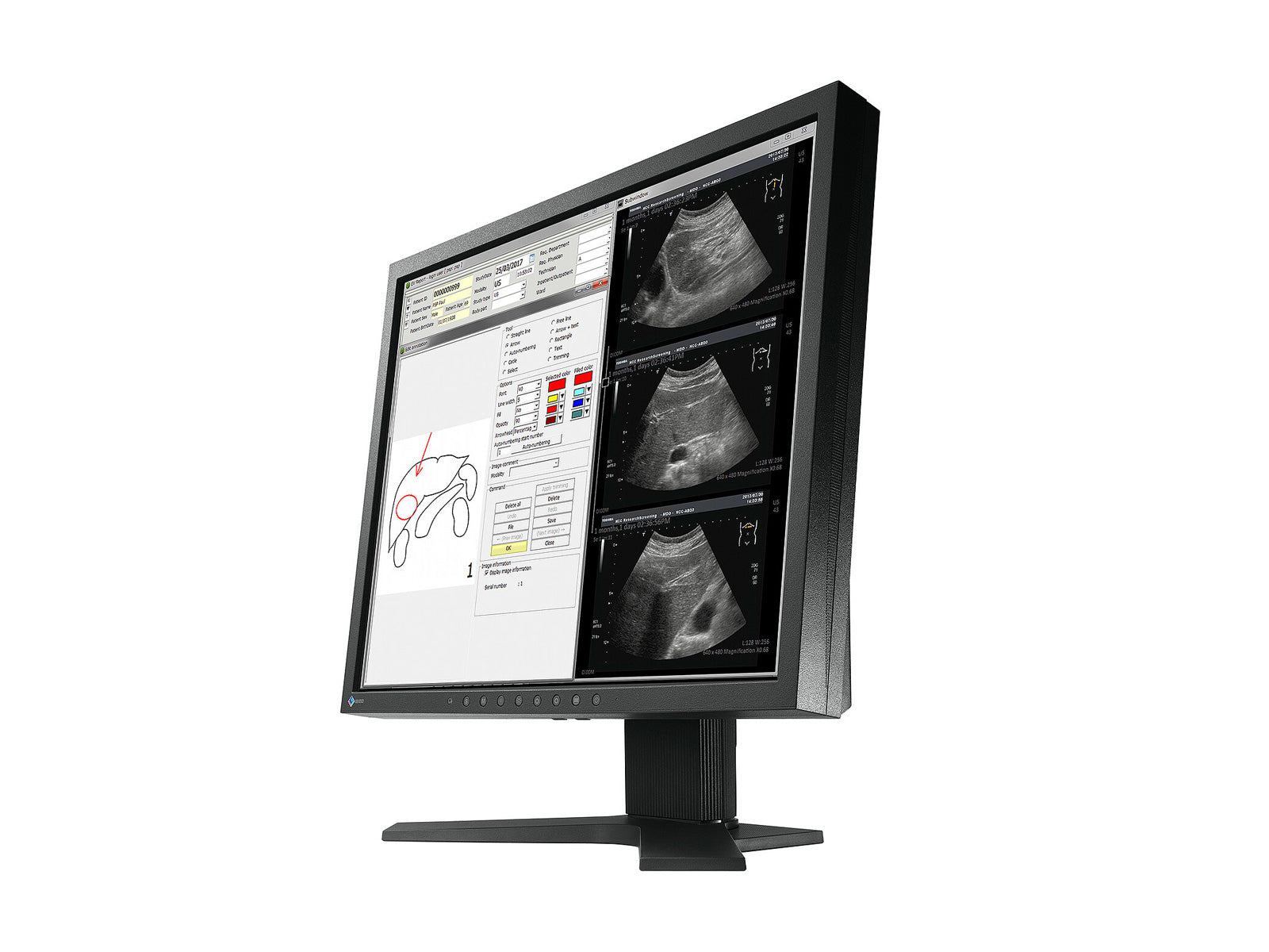 Eizo Radiforce MX194 1MP 19" Clinical Review Monitor (MX194)