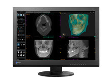 Eizo RadiForce MX242W 2.3MP 24" Visor LED colorido de revisão clínica (MX242W-BK)