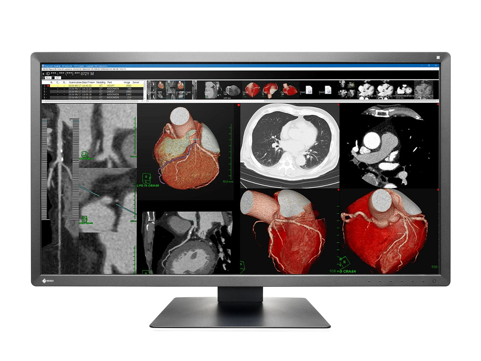 Komplette PACS-Station für allgemeine Radiologie | Eizo 8MP Farbdisplays | HP Z4 G5 Workstation | Diktiermikrofon | Arbeitsvorratsmonitor (MX317WZ4G5)